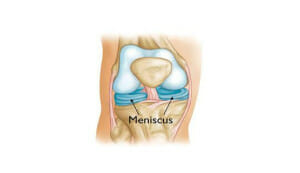 Meniscus St. George Surgical Center