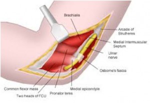 cubital