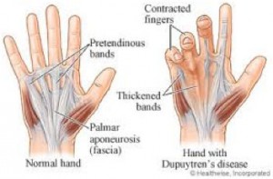hand-surgery-utah