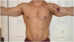 pectoralis St. George Surgical Center