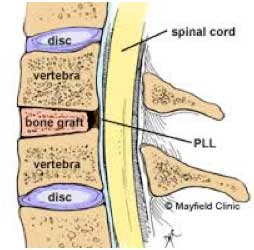 Spinal Cord Column
