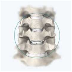 Spinal bones