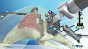 St. George Surgical Center OrthAlign